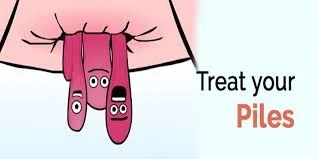 piles clinic in naini prayagraj